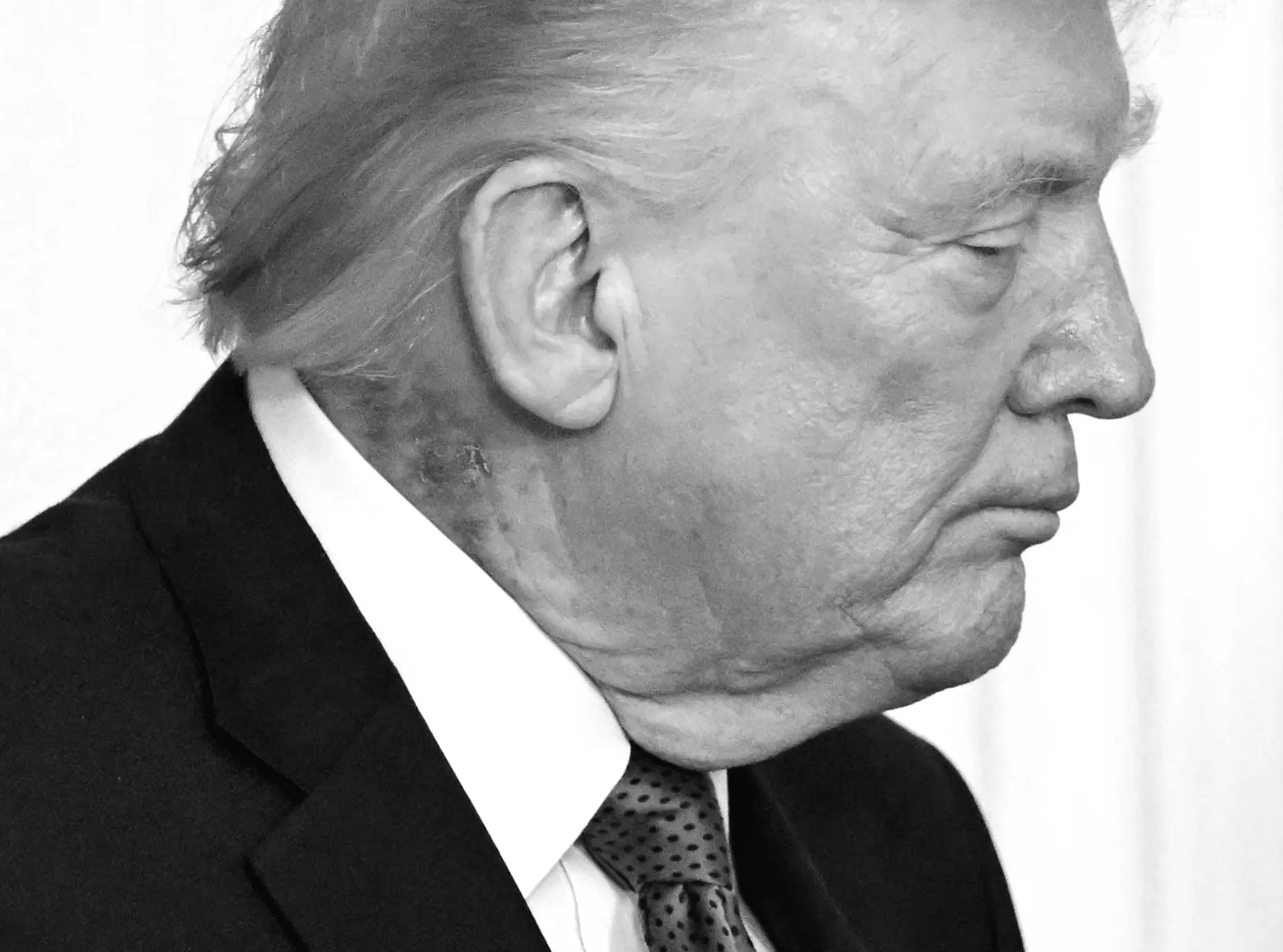 Лікар Трампа пояснив, що шиячний висип - наслідок профілактичного догляду за шкірою.