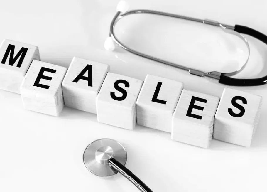 США переживають найбільший випадок кору з 2000 року - 5 ключових матеріалів про ризики, що робити і що чекати далі