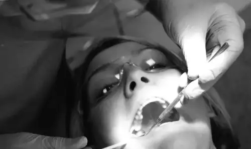 Лікарі стоматологи повертають £900 млн за ненадання медичної допомоги через Національну службу здоров'я