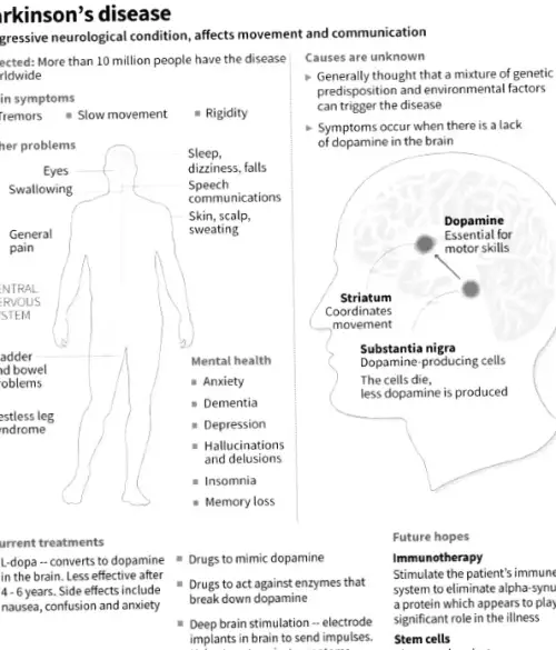 Японія схвалила лікування хвороби Паркінсона за допомогою стовбурових клітин - світовий перший випадок